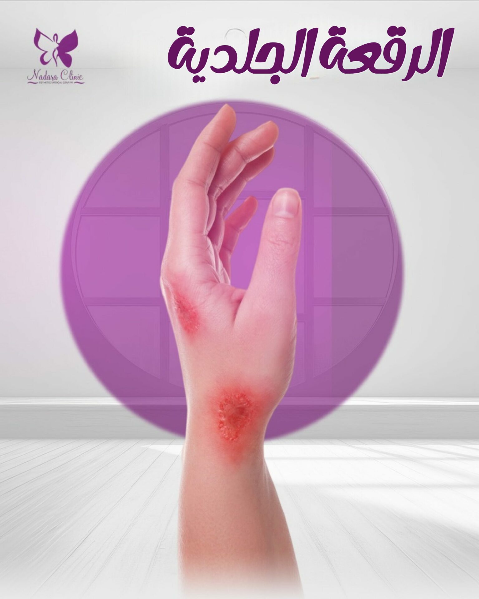 الرقعة الجلدية